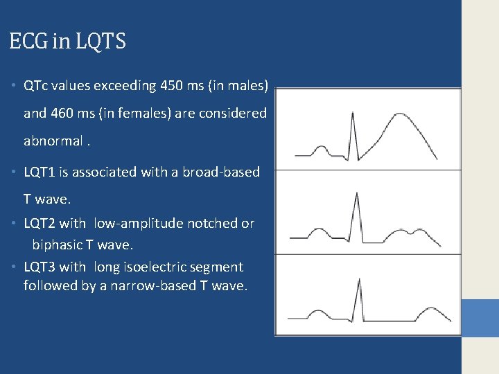 ECG in LQTS • QTc values exceeding 450 ms (in males) and 460 ms