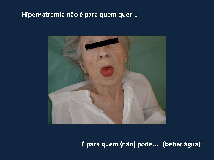 Hipernatremia não é para quem quer. . . É para quem (não) pode. .