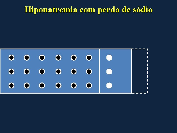 Hiponatremia com perda de sódio 