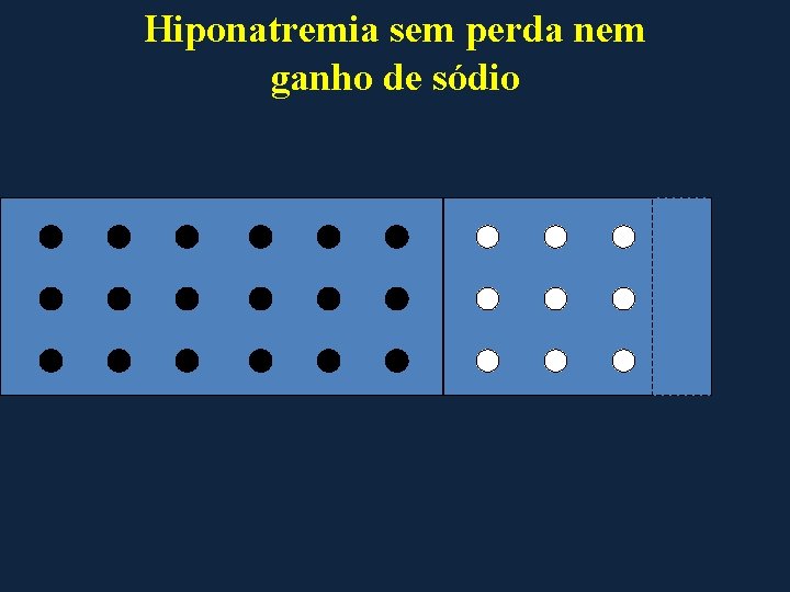 Hiponatremia sem perda nem ganho de sódio 