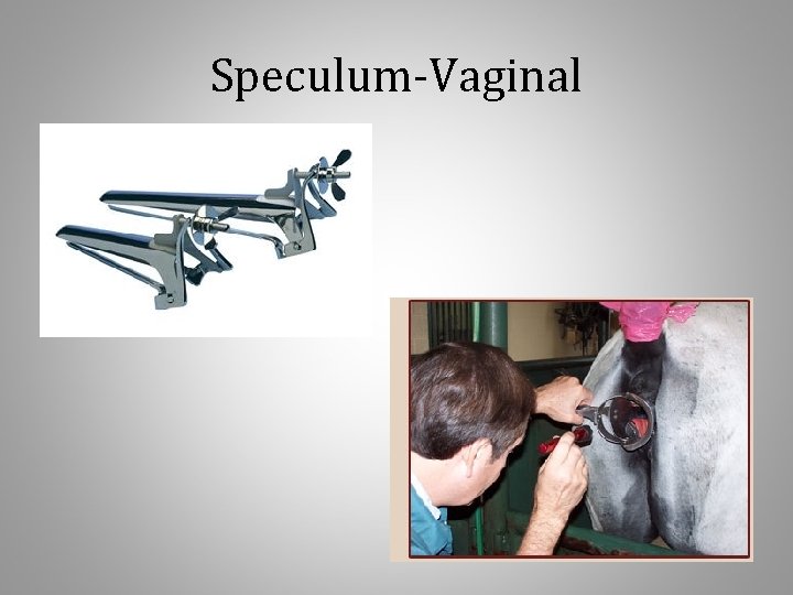 Speculum-Vaginal 