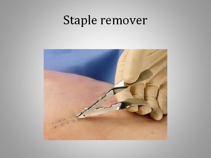Staple remover 