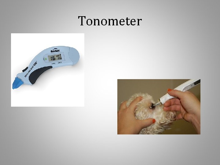 Tonometer 
