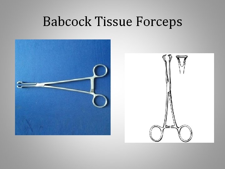 Babcock Tissue Forceps 