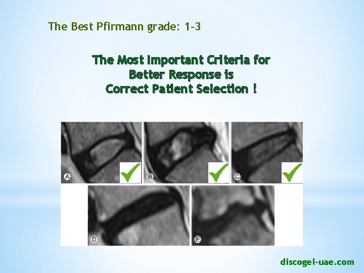 The Best Pfirmann grade: 1 -3 The Most Important Criteria for Better Response is
