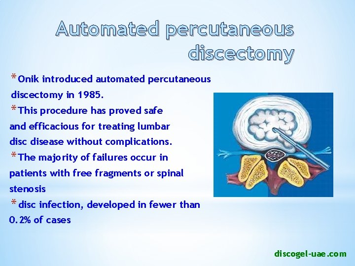 Automated percutaneous discectomy * Onik introduced automated percutaneous discectomy in 1985. * This procedure