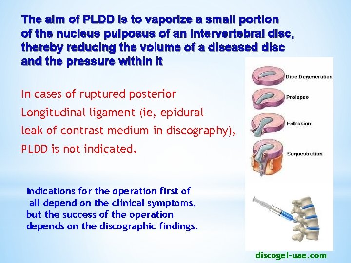 The aim of PLDD is to vaporize a small portion of the nucleus pulposus