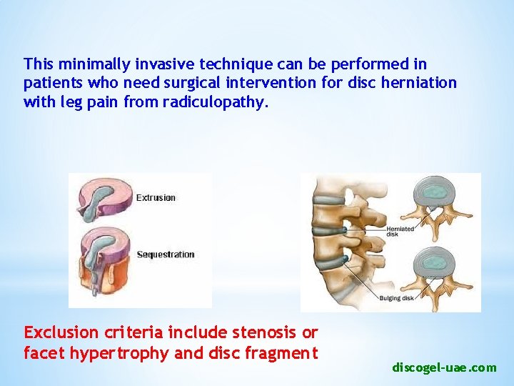 This minimally invasive technique can be performed in patients who need surgical intervention for