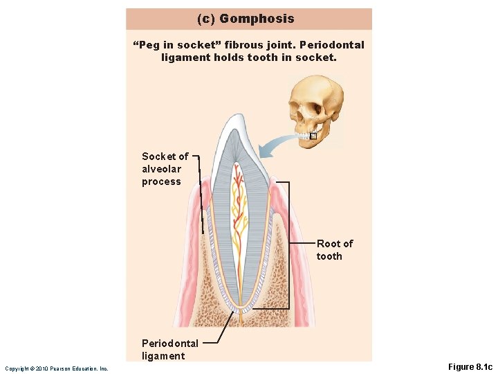 (c) Gomphosis “Peg in socket” fibrous joint. Periodontal ligament holds tooth in socket. Socket