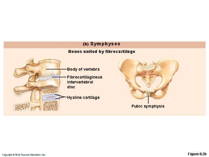 (b) Symphyses Bones united by fibrocartilage Body of vertebra Fibrocartilaginous intervertebral disc Hyaline cartilage
