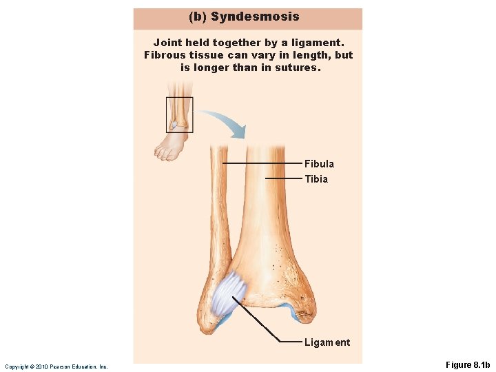 (b) Syndesmosis Joint held together by a ligament. Fibrous tissue can vary in length,