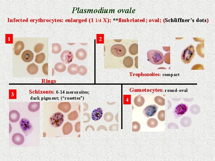 Plasmodium ovale Infected erythrocytes: enlarged (1 1/4 X); **fimbriated; oval; (Schüffner’s dots) 1 2