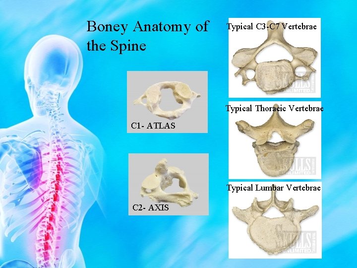 Boney Anatomy of the Spine Typical C 3 -C 7 Vertebrae Typical Thoracic Vertebrae