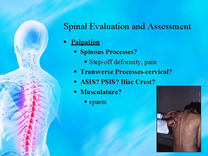 Spinal Evaluation and Assessment § Palpation § Spinous Processes? § Step-off deformity, pain §