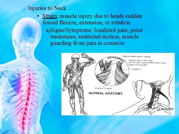 Injuries to Neck • Strain: muscle injury due to heads sudden forced flexion, extension,