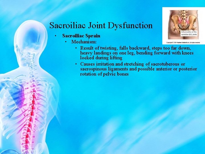Sacroiliac Joint Dysfunction • Sacroiliac Sprain • Mechanism: • Result of twisting, falls backward,