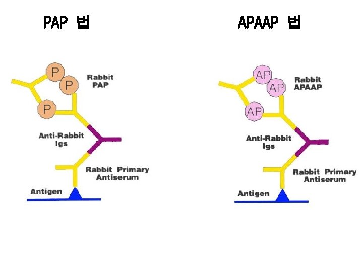 PAP 법 APAAP 법 