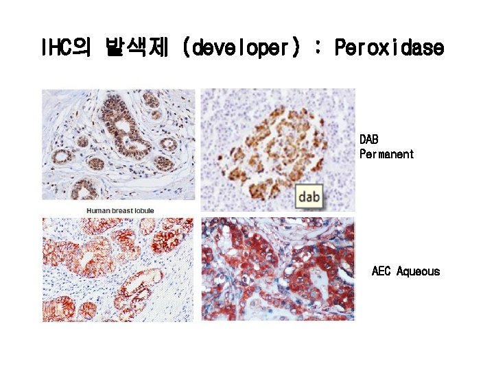 IHC의 발색제 (developer) : Peroxidase DAB Permanent AEC Aqueous 