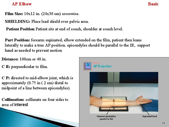 AP Elbow Basic Film Size: 10 x 12 in. (24 x 30 cm) crosswise.