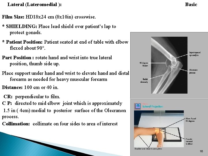  Lateral (Lateromedial ): Basic Film Size: HD 18 x 24 cm (8 x