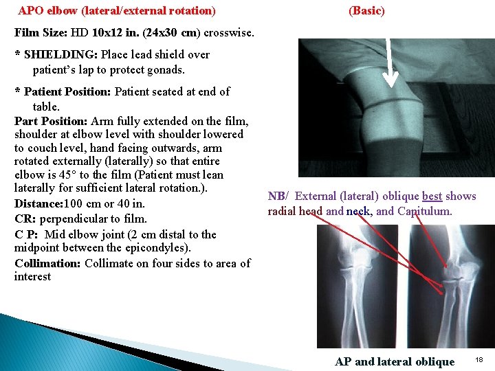 APO elbow (lateral/external rotation) (Basic) Film Size: HD 10 x 12 in. (24