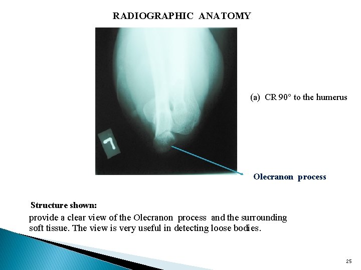 RADIOGRAPHIC ANATOMY (a) CR 90 to the humerus Olecranon process Structure shown: provide a