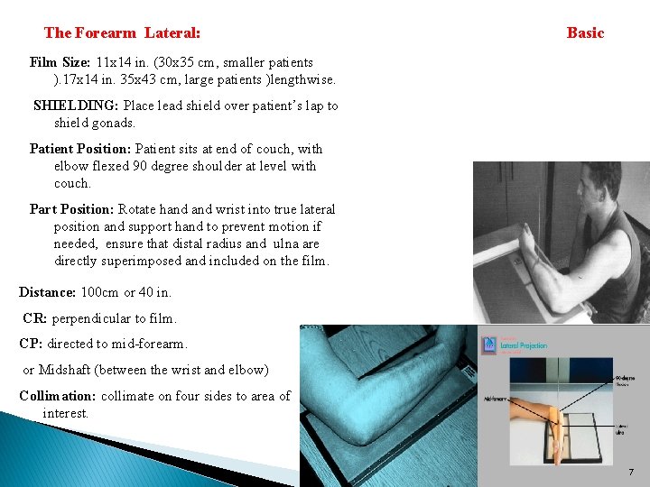  The Forearm Lateral: Basic Film Size: 11 x 14 in. (30 x 35