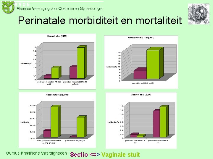 Perinatale morbiditeit en mortaliteit Cursus Praktische Vaardigheden Sectio <=> Vaginale stuit 