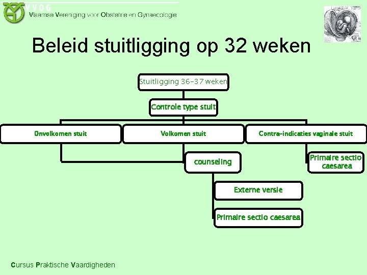Beleid stuitligging op 32 weken Stuitligging 36 -37 weken Controle type stuit Onvolkomen stuit