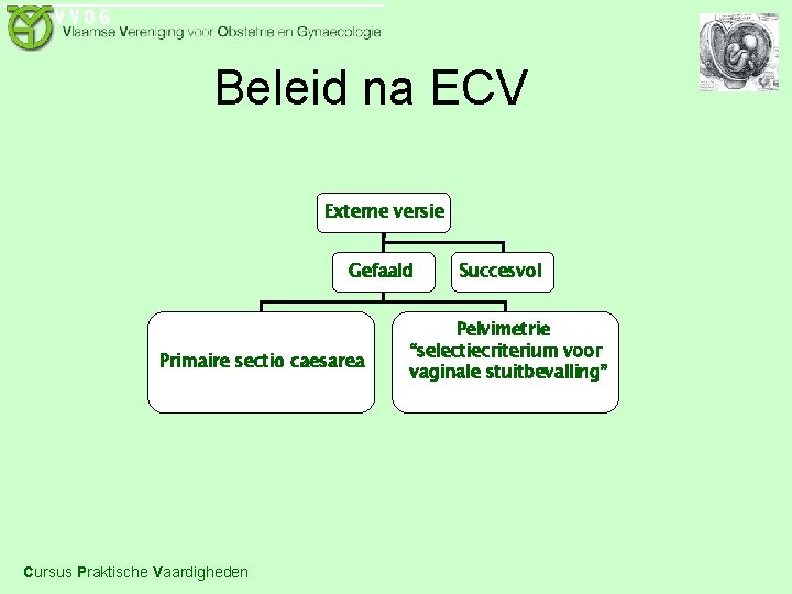 Beleid na ECV Externe versie Gefaald Primaire sectio caesarea Cursus Praktische Vaardigheden Succesvol Pelvimetrie