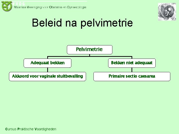 Beleid na pelvimetrie Pelvimetrie Adequaat bekken Bekken niet adequaat Akkoord voor vaginale stuitbevalling Primaire