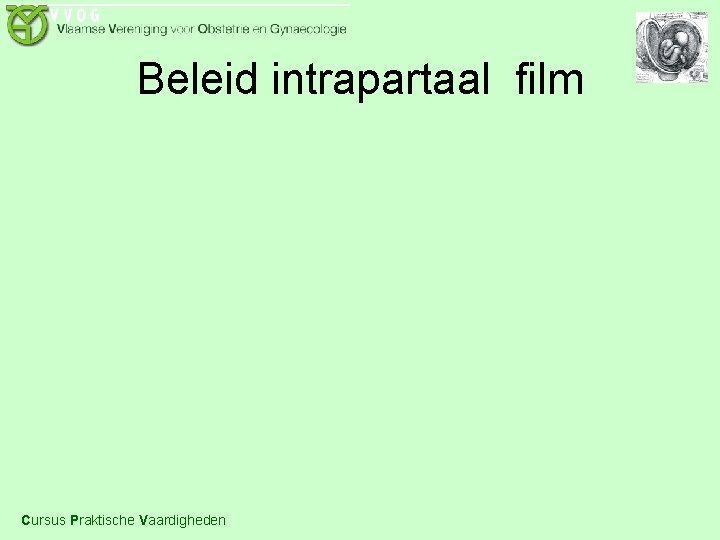 Beleid intrapartaal film Cursus Praktische Vaardigheden 