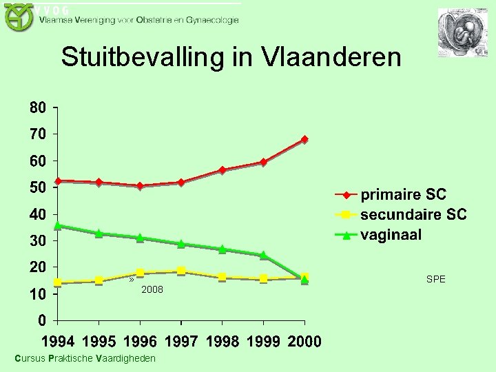 Stuitbevalling in Vlaanderen » 2008 Cursus Praktische Vaardigheden SPE 