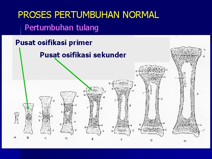 PROSES PERTUMBUHAN NORMAL Pertumbuhan tulang Pusat osifikasi primer Pusat osifikasi sekunder 