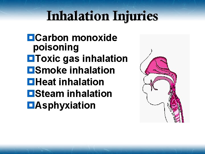 Inhalation Injuries ¥Carbon monoxide poisoning ¥Toxic gas inhalation ¥Smoke inhalation ¥Heat inhalation ¥Steam inhalation