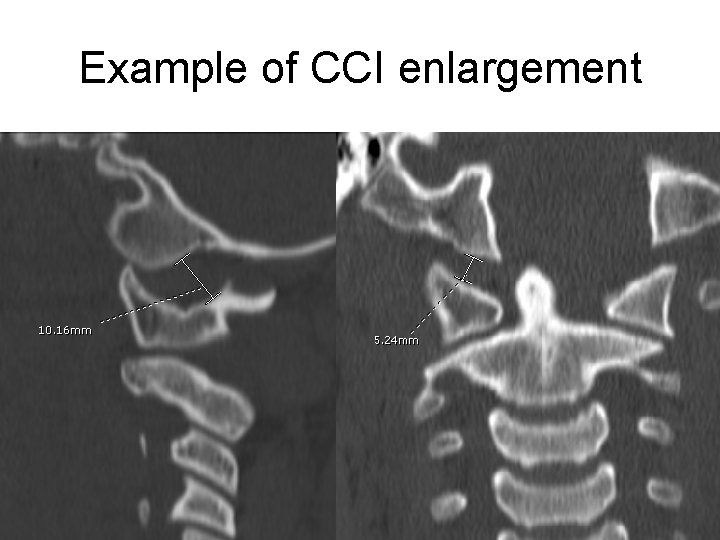 Example of CCI enlargement 