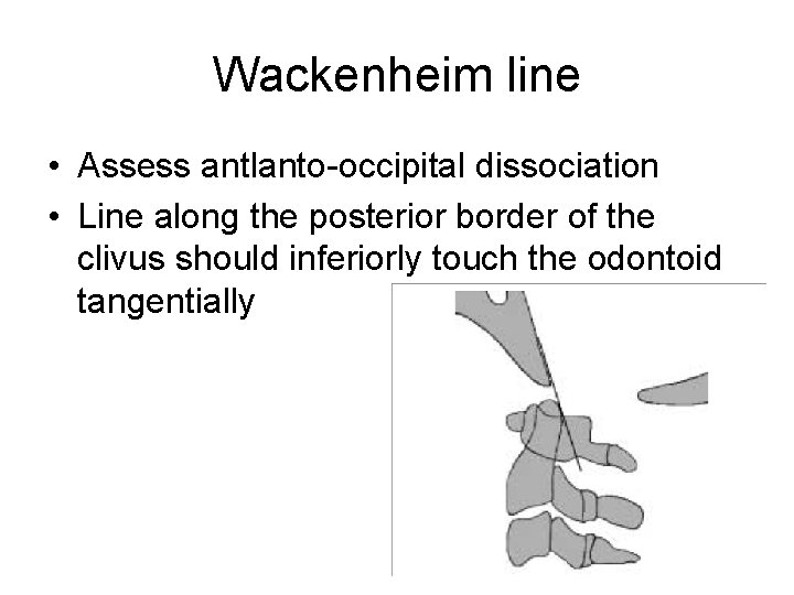 Wackenheim line • Assess antlanto-occipital dissociation • Line along the posterior border of the