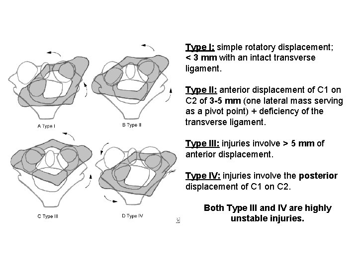 Type I: simple rotatory displacement; < 3 mm with an intact transverse ligament. Type