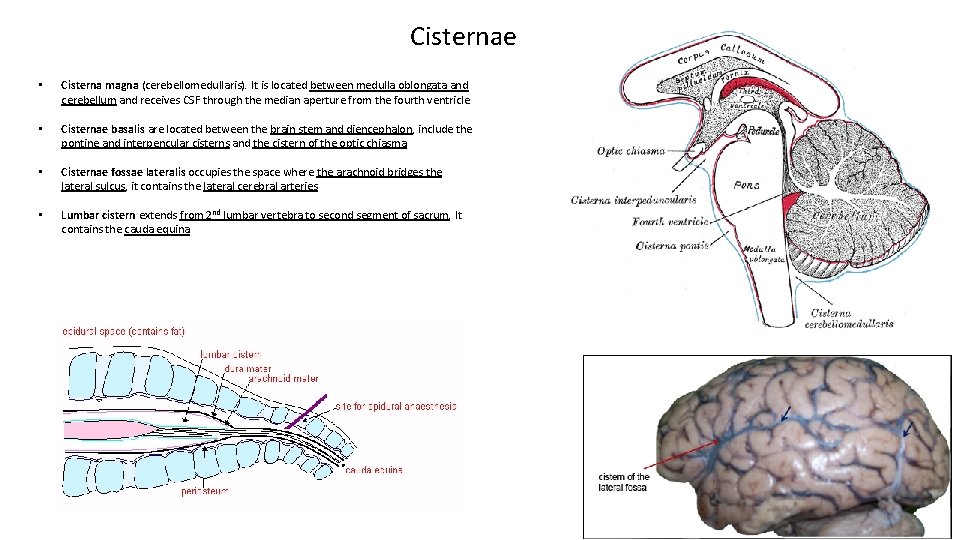 Cisternae • Cisterna magna (cerebellomedullaris). It is located between medulla oblongata and cerebellum and