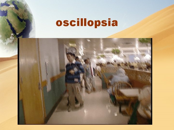 oscillopsia 