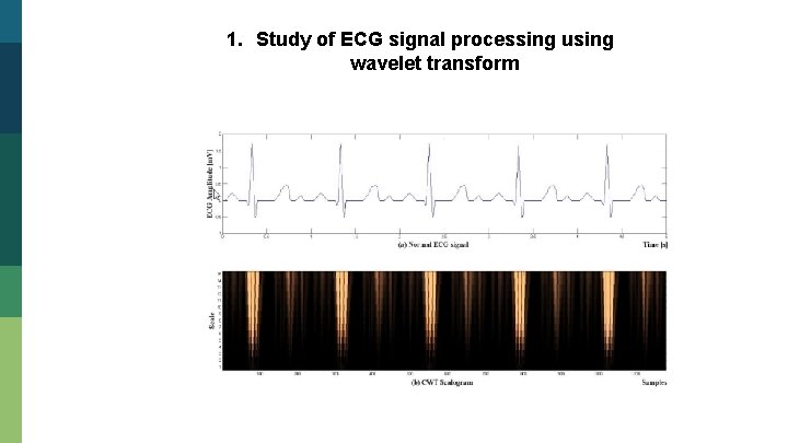 1. Study of ECG signal processing using wavelet transform 