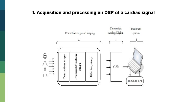 4. Acquisition and processing on DSP of a cardiac signal 