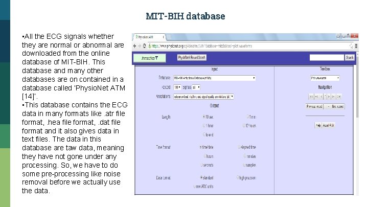 MIT-BIH database • All the ECG signals whether they are normal or abnormal are