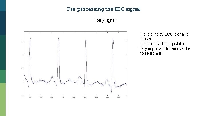 Pre-processing the ECG signal Noisy signal • Here a noisy ECG signal is shown.