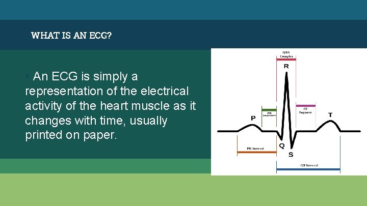 WHAT IS AN ECG? ▪ An ECG is simply a representation of the electrical