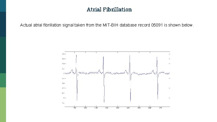Atrial Fibrillation Actual atrial fibrillation signal taken from the MIT-BIH database record 05091 is
