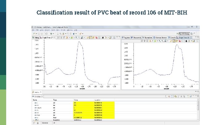 Classification result of PVC beat of record 106 of MIT-BIH 