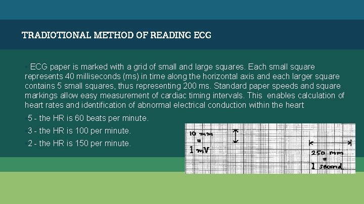 TRADIOTIONAL METHOD OF READING ECG ▪ ECG paper is marked with a grid of