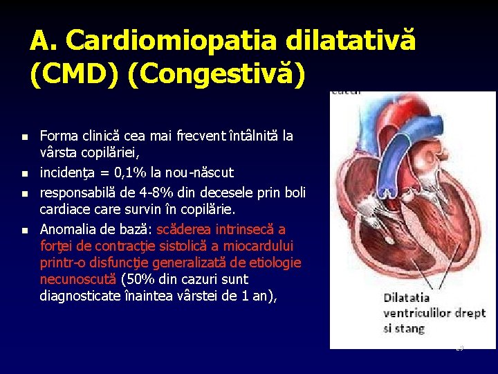 A. Cardiomiopatia dilatativă (CMD) (Congestivă) n n Forma clinică cea mai frecvent întâlnită la