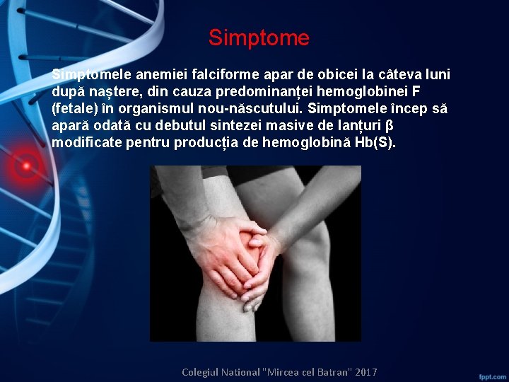 Simptomele anemiei falciforme apar de obicei la câteva luni după naștere, din cauza predominanței
